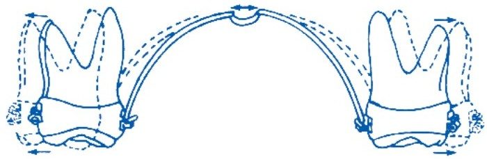 How the loop applies force to the molar